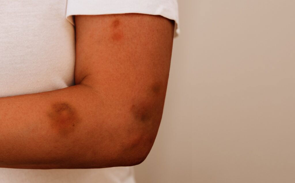 Fulton County Under ‘Domestic Violence Epidemic’ With Nearly 1,000 Cases In Metro Atlanta